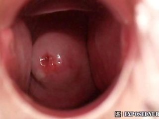 Enfermera zaneta espéculo masturbación en clínica